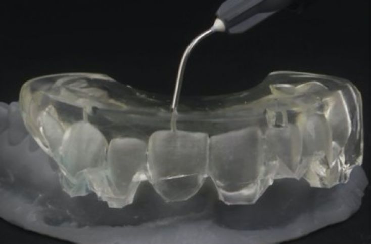 resin injection moulding smile design