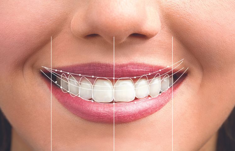 Digital Smile Design Service